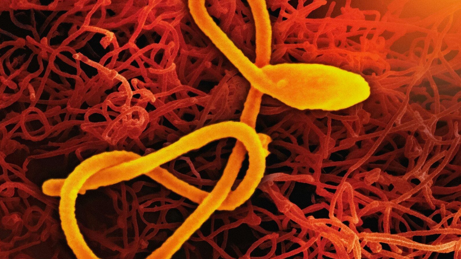 Ébola en RD Congo: OMS reporta 321 casos confirmados y Chile refuerza vigilancia sanitaria