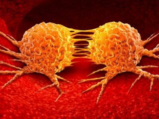 Ataca mientras descansamos: Estudio revela que la metástasis del cáncer es más agresiva durante la noche