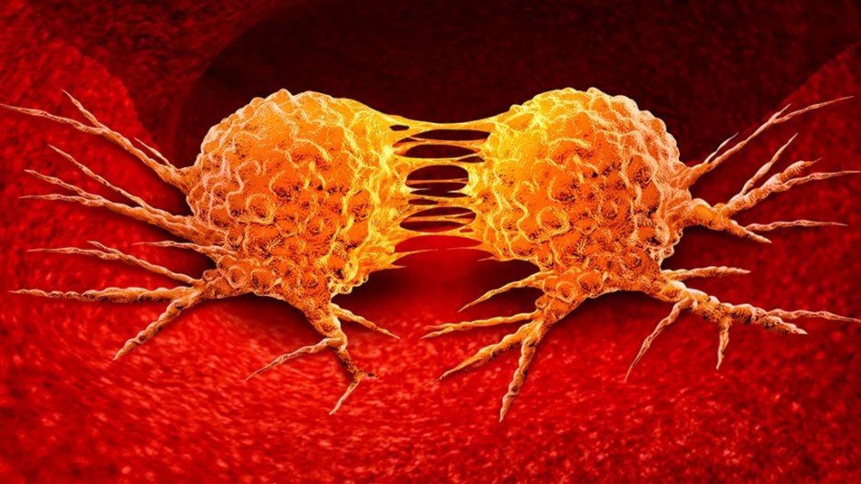 Ataca mientras descansamos: Estudio revela que la metástasis del cáncer es más agresiva durante la noche